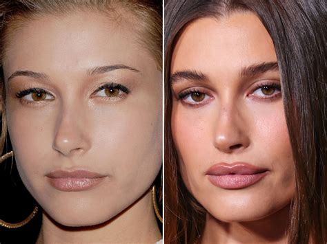 Hailey Bieber Before And After From 2009 To 2022 The Skincare Edit