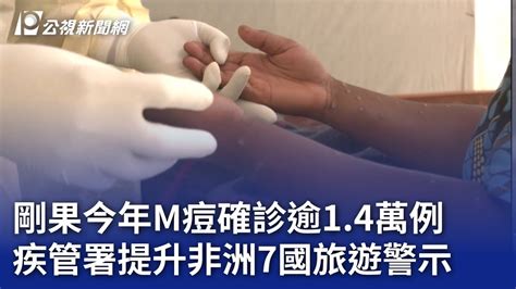 剛果今年m痘確診逾14萬例 疾管署提升非洲7國旅遊警示｜20240815 公視晚間新聞 Youtube