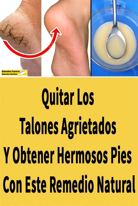 Quitar Los Talones Agrietados Y Obtener Hermosos Pies Con Este Remedio