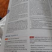 Fallbuch Innere Medizin Mit 155 Fällen Plus Online Version in via