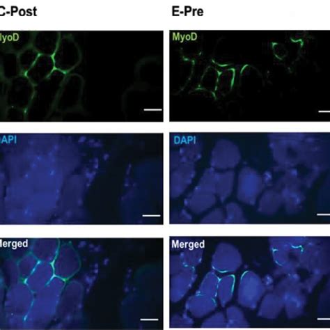 Immunofluorescence Myod Staining Positive Satellite Cell Population