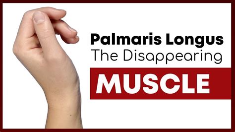 Palmaris Longus The Muscle You Might Not Have Corporis YouTube