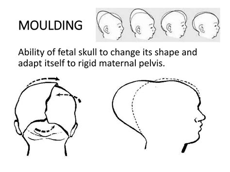 Maternal Pelvis And Fetal Skull Ppt