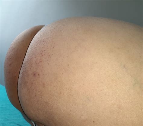 My Ass Ready For A Cock Pics Xhamster