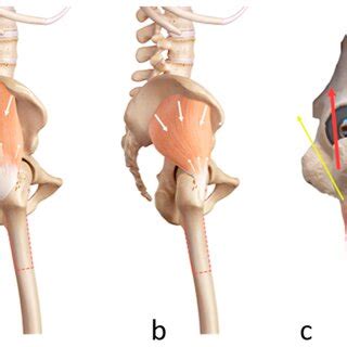 (a). Anatomy of the gluteus medius muscle: the gluteus medius muscle ...