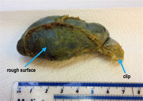 Make Your Own Gallbladder Of Course Histology Blog