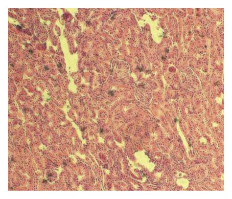 Histopathological Change In Rat Arthrodial Cartilage Photomicrographs