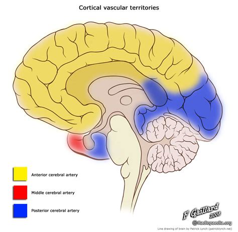 Cerebral Vascular Anatomy Headache Treatments