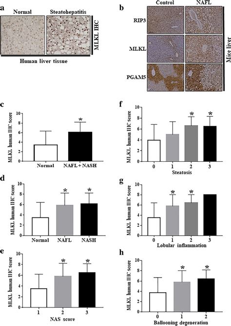 Mixed Lineage Kinase Domain Like Pseudokinase Mlkl Expression