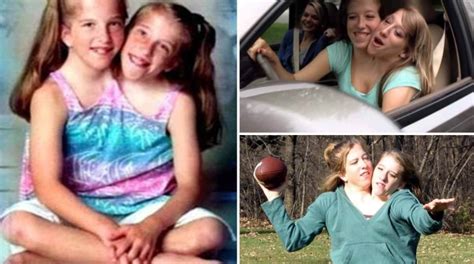 Conjoined Twin Sisters Abby And Brittany Hensel Where Are They Now American Stories