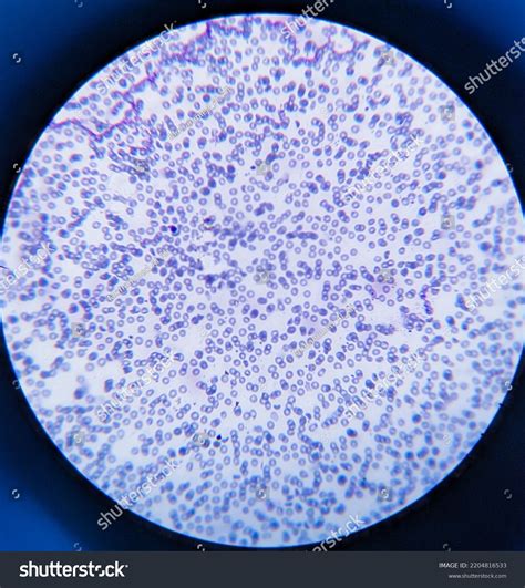 Photo Human Blood Smear Under Microscope Stock Photo 2204816533 ...