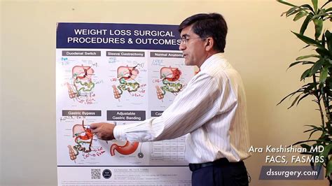 Weight Loss Surgical Procedures Part 7 Summary Youtube