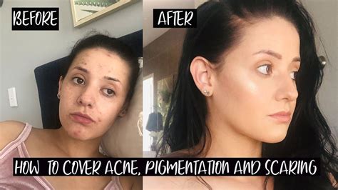 How To Cover A Scab W Makeup