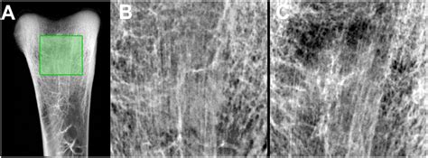 X-ray image of the region of interest at the tibia used for ...