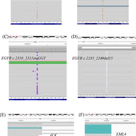 Integrative Genomics Viewer Igv Screenshots Of The Target Variants In