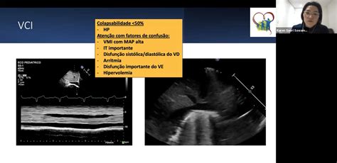 Dcc Cp Avalia O Ecocardiogr Fica Na Hipertens O Pulmonar Neonatal