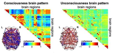 What is Consciousness? Brain Scans are Starting to Reveal the Unique ...