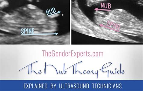 Nub Theory - Highly Reliable Early Gender Prediction | Nub theory ...