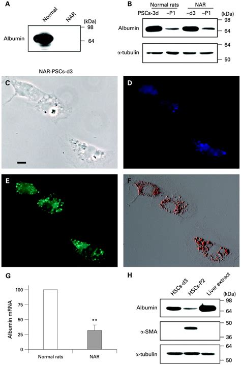 Formation Of Vitamin A Lipid Droplets In Pancreatic Stellate Cells Requires Albumin Gut