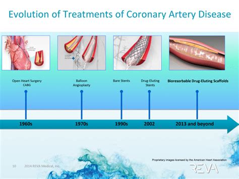 Coronary Artery Disease Treatment Slideshare Ppt - PELAJARAN