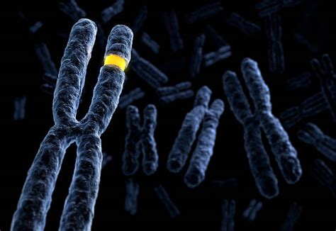 6800 Chromosomal Abnormalities Stock Photos Pictures And Royalty Free