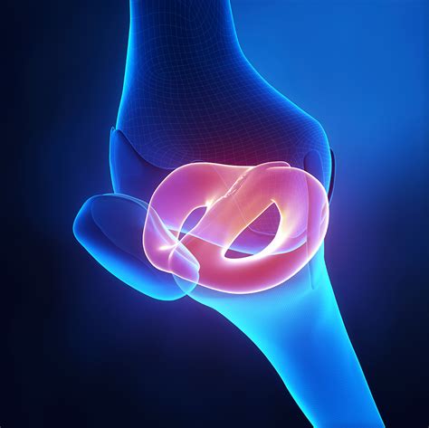 Anatomy Of The Knee Diagram Torn Meniscus