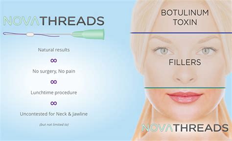 Pdo Thread Liftnonsurgical Facelift With Novathreads Bsi