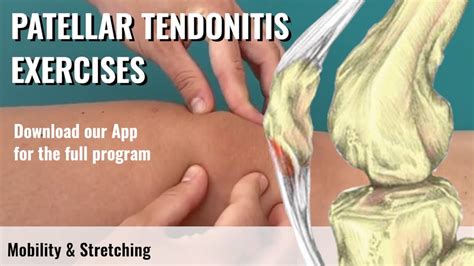 Patellar Tendonitis Exercises Jumpers Knee Youtube