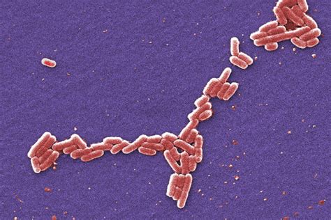 墨西哥湾出现“致死率50％”病菌 Cdc证实已有3人感染 全球新闻流 六度世界