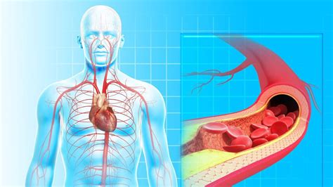 Mia D Yca Przyczyny Objawy Leczenie Medicus