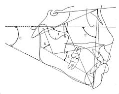 Angular Measurements For Vert Index 1 Facial Axis 2 Facial Depth Download Scientific