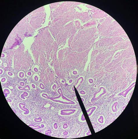 Histology Uterus Diagram Quizlet