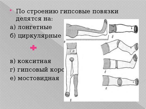 Гипсовые повязки