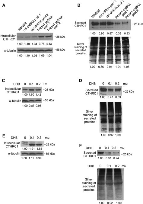 Effect Of P Ha Protein Downregulation Or Treatment With A Prolyl