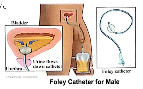 Types Of Urine Specimen And Urine Preservatives Flashcards Quizlet