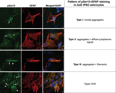 Figures And Data In Site Specific Phosphorylation And Caspase Cleavage