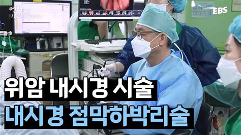 명의 내시경으로 암 조직을 떼어내는 과정 위암 내시경 시술 YouTube