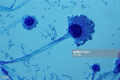 Aspergillus Flavus Stock Photo | Getty Images in 2024 | Yahoo images, Stock photos, Image search