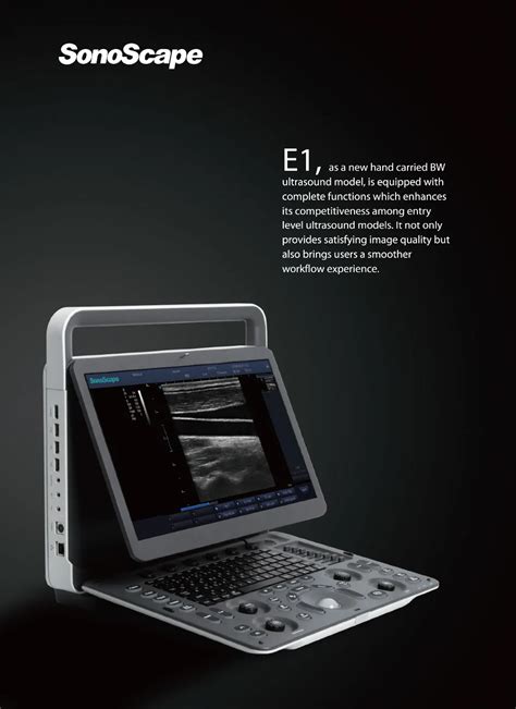 Cheap Sonoscape E1 Classical Black White Image Portable Ultrasound