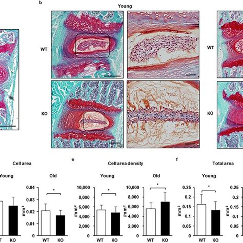 Caspase 3 Knockout KO Mice Present A Smaller Nucleus Pulposus NP