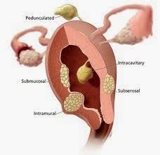 Medical Treatment Pictures-for Better Understanding: Abdominal ...