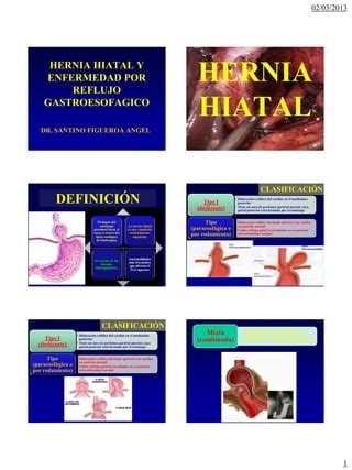 Hernia Hiatal Esofagitis Y Erge PDF