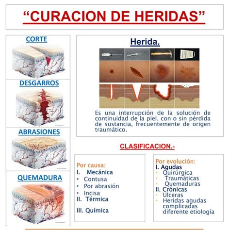 Infografia Curacion De Heridas Pdf