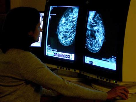 Drug Offers Lifeline To 1600 Women With Rare Aggressive Form Of Breast Cancer Guernsey Press