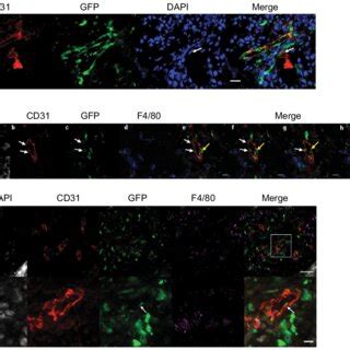 Incorporation Of Gfp Bone Marrowderived Cells In Llc Tumor Blood