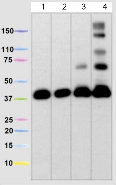 Total Oxphos Rodent Wb Antibody Cocktail Ab Abcam