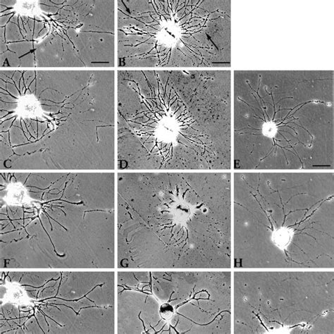 Photomicrographs Of A Cell After Transecting Neurites In Vitro A The