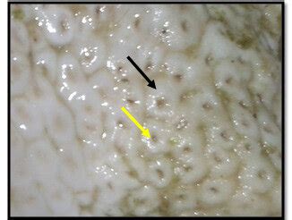 Inner surface of the proventriculus showing the proventiriulus gland ...