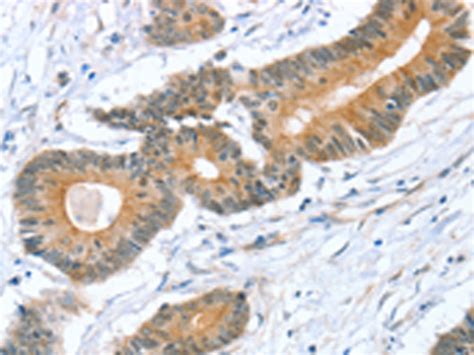 STXBP1 Antibody - SAB | Signalway Antibody