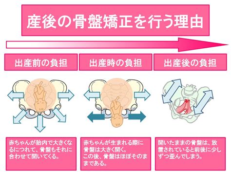 産後骨盤矯正｜津山市・真庭市・美作市のおおくら整骨院 津山市 おおくら整骨院